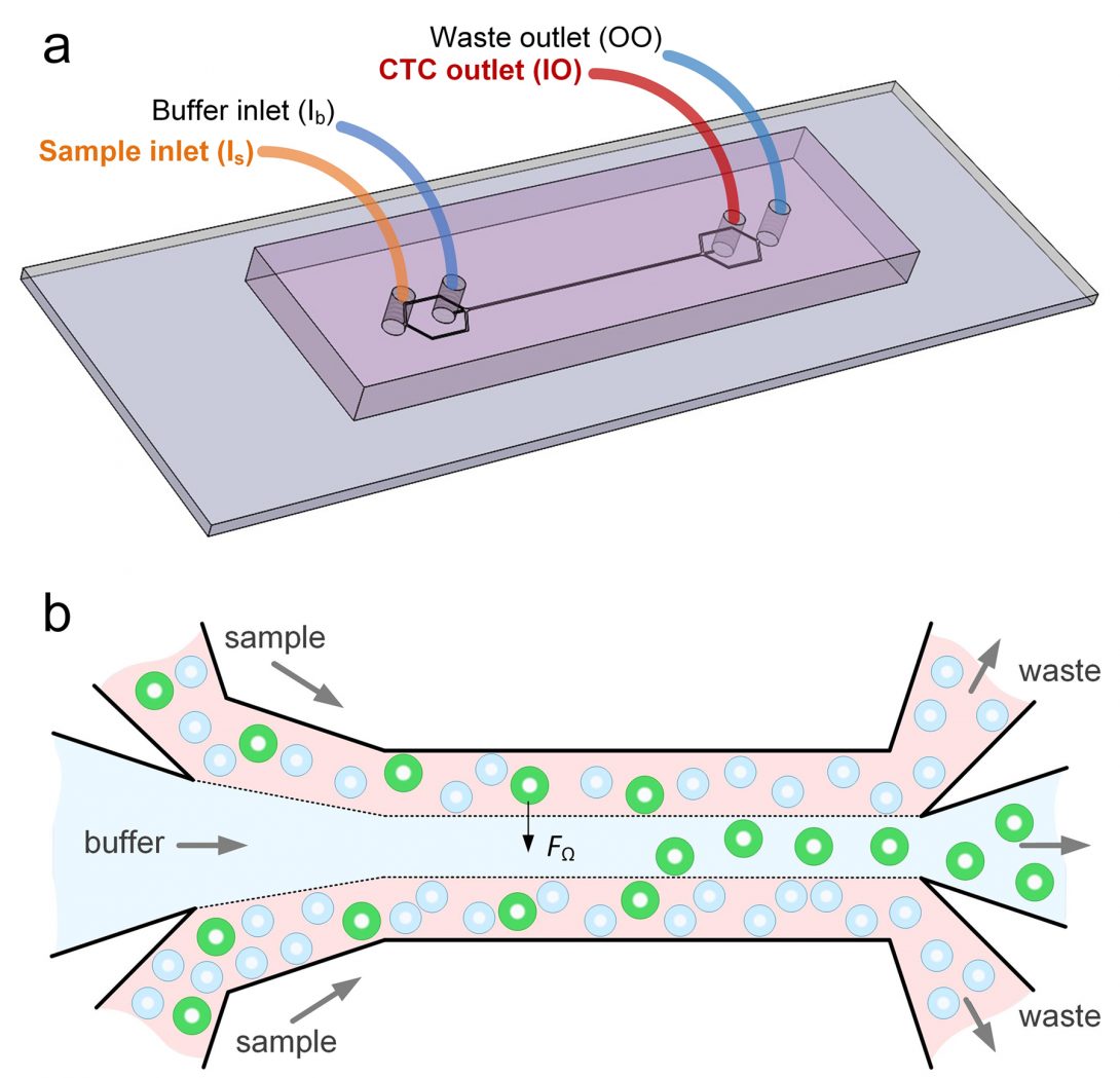 Diagram of microfluidics device that separates cancer cells from blood