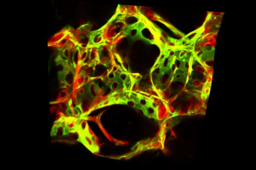 Fluorescence microscopy image of the lung with blood vessel endothelial cells shown in green and non-endothelial cells in red
