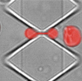 Left: Electron microscopy image of a 0.28-micron wide silicon bridge (in light gray) used for molding 0.28-micron wide slits. Right: Superimposed images of an RBC (in red) passing through a 0.28x1.87x5.0 μm3 slit. 