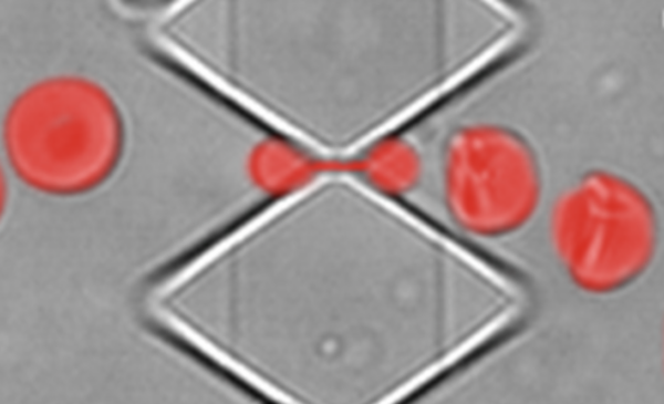 Top left: Electron microscopy image of a 0.28-micron wide silicon bridge (in light gray) used for molding 0.28-micron wide slits. Top right: Superimposed images of an RBC (in red) passing through a 0.28x1.87x5.0 μm3 slit.