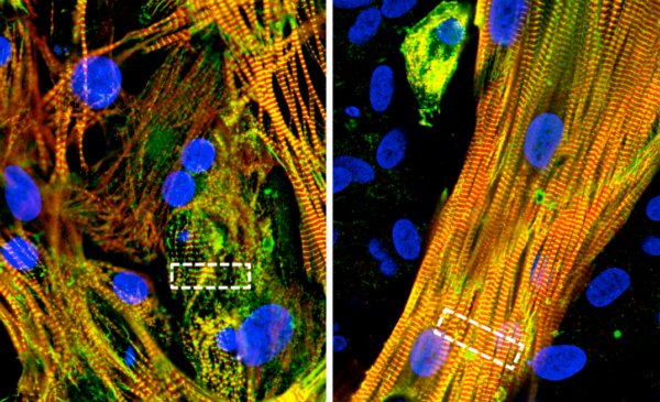 Micropatterned cultures of atrial stem cells and fibroblasts (right) spontaneously formed muscle-like structures, unlike unpatterned cultures of stem cells alone (left).