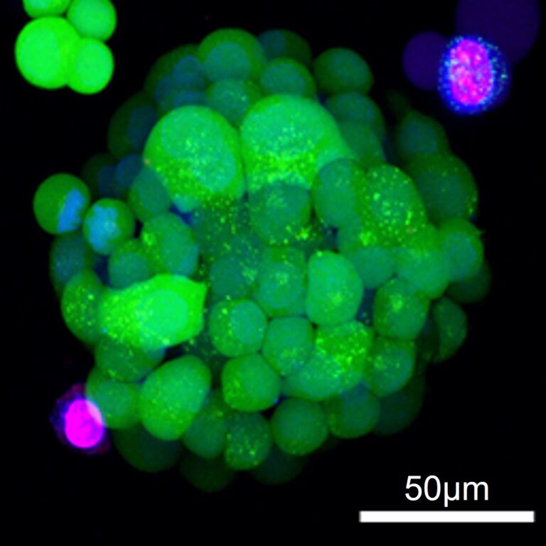 A lung cancer organoid simulating a cluster of tumor cells for drug screening.